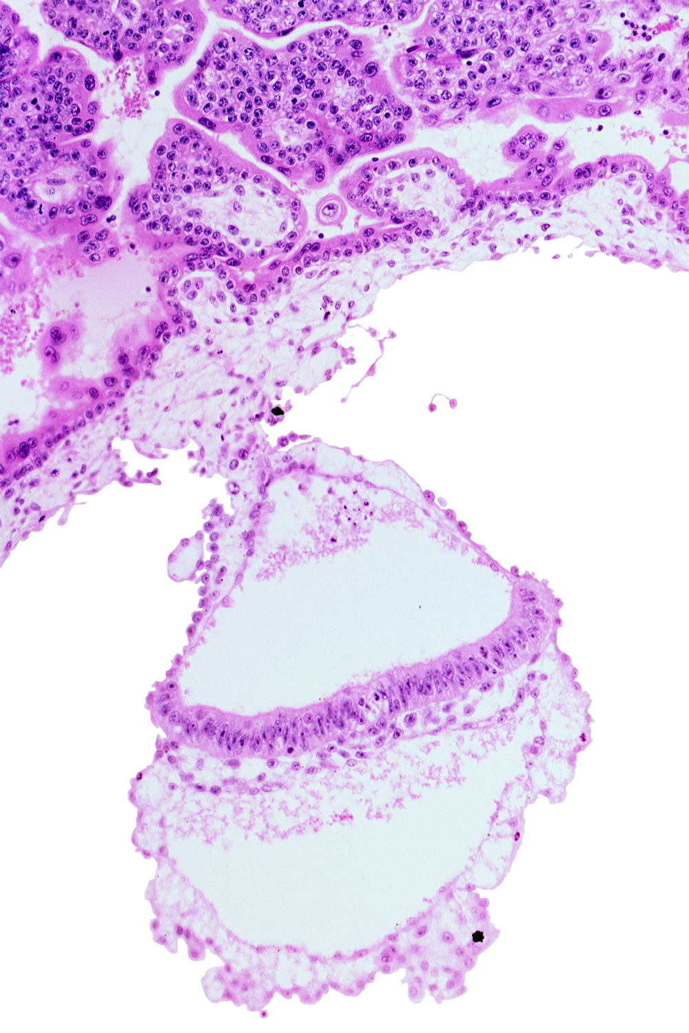 extra-embryonic ectoderm, head mesenchyme, hypoblast, one-layered epiblast