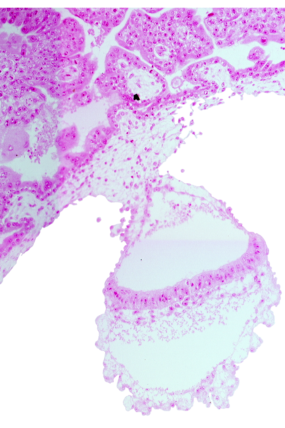 amniotic mesenchyme, connecting stalk, gastrulation (primitive) node, head mesenchyme, hypoblast, lateral edge of embryonic disc, mesothelium
