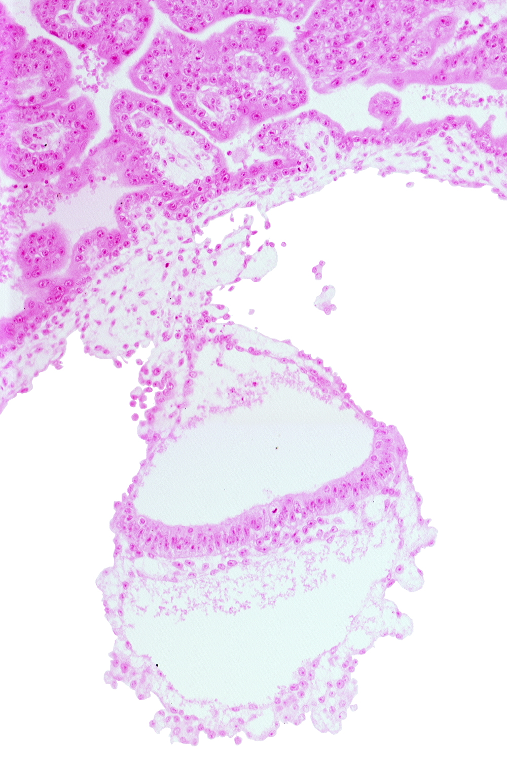 amniotic mesenchyme, connecting stalk, gastrulation (primitive) node, head mesenchyme, lateral edge of embryonic disc, mesothelium