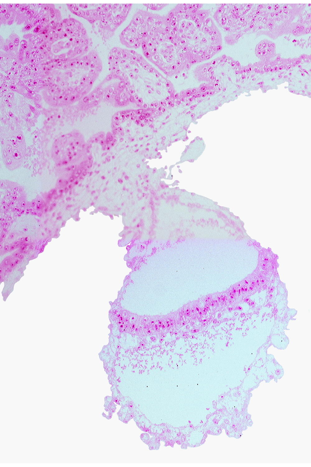 connecting stalk, gastrulation (primitive) node, head mesenchyme, lateral edge of embryonic disc, mesothelium