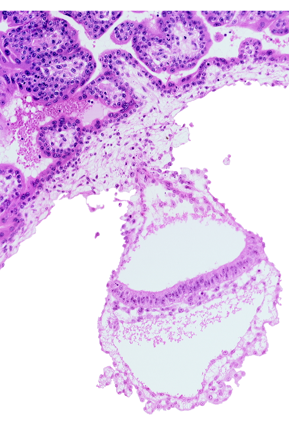 cephalic edge of amniotic duct, connecting stalk, embryonic endoderm, embryonic mesoderm, epiblast, extra-embryonic ectoderm, extra-embryonic endoderm, gastrulation (primitive) streak, umbilical vesicle cavity