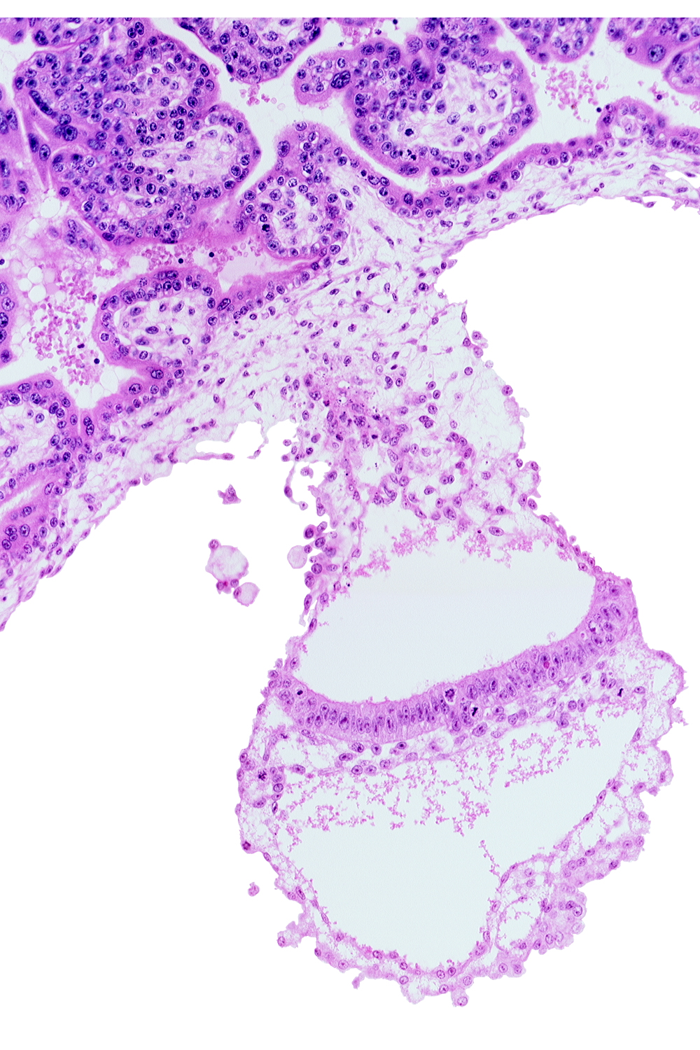 amnion, amniotic cavity, cephalic part of amniotic duct, embryonic endoderm, embryonic mesoderm, epiblast, extra-embryonic mesoblast, gastrulation (primitive) streak, primordial blood vessel(s), umbilical vesicle cavity