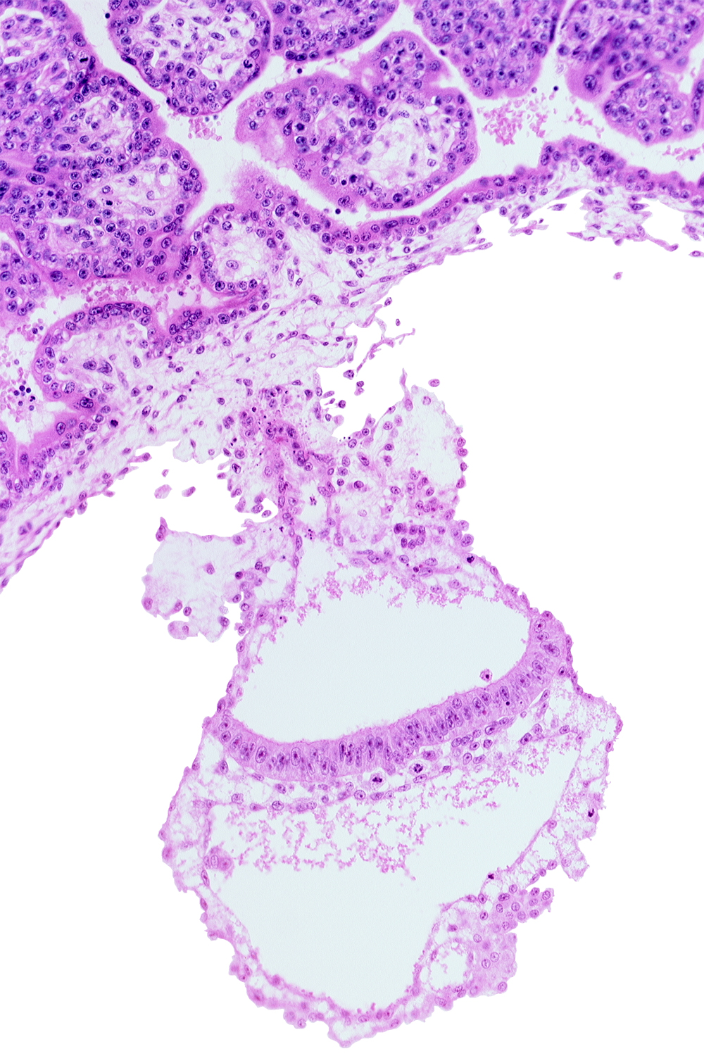 amnion, amniotic cavity, cephalic part of amniotic duct, embryonic endoderm, embryonic mesoderm, epiblast, gastrulation (primitive) streak, umbilical vesicle cavity