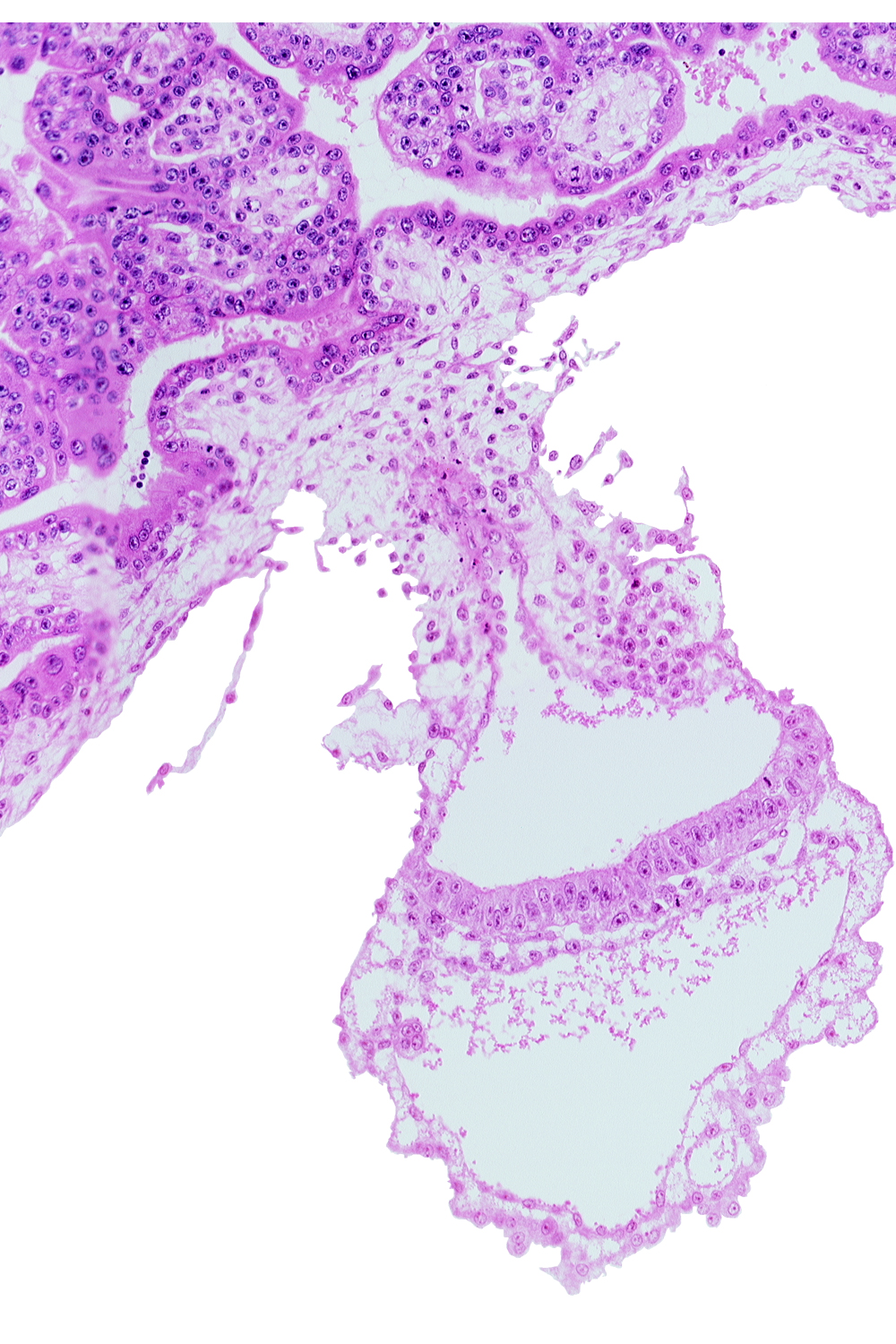 connecting stalk, cyst in umbilical vesicle wall, embryonic endoderm, embryonic mesoderm, gastrulation (primitive) streak, lateral edge of embryonic disc, middle part of amniotic duct, presumptive angioblastic tissue