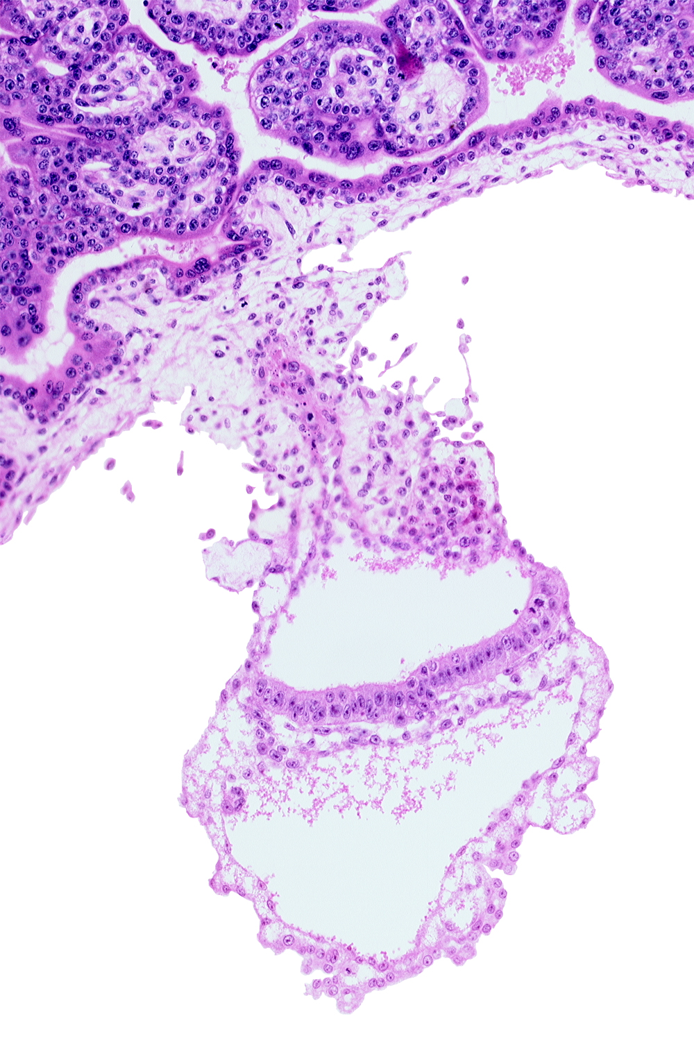 amniotic cavity, connecting stalk, cyst in umbilical vesicle wall, embryonic endoderm, embryonic mesoderm, gastrulation (primitive) streak, lateral edge of embryonic disc, presumptive angioblastic tissue, umbilical vesicle cavity