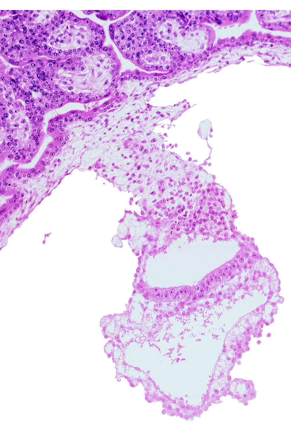 connecting stalk, embryonic endoderm, embryonic mesoderm, epiblast, extra-embryonic endoderm, gastrulation (primitive) groove, gastrulation (primitive) streak