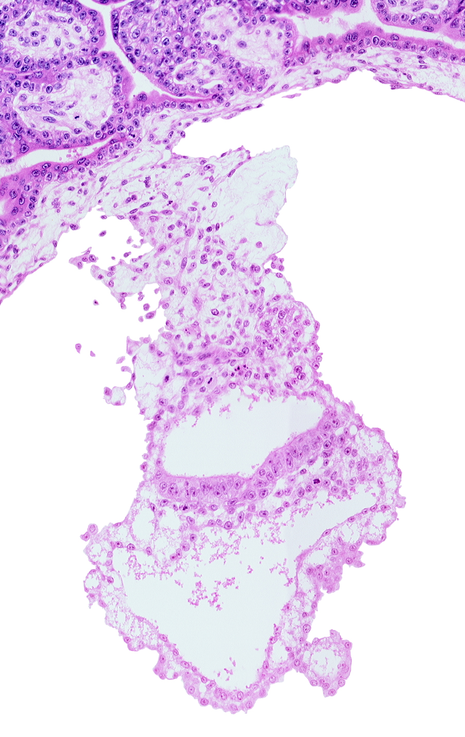 connecting stalk, embryonic endoderm, embryonic mesoderm, epiblast, extra-embryonic endoderm, gastrulation (primitive) groove, gastrulation (primitive) streak