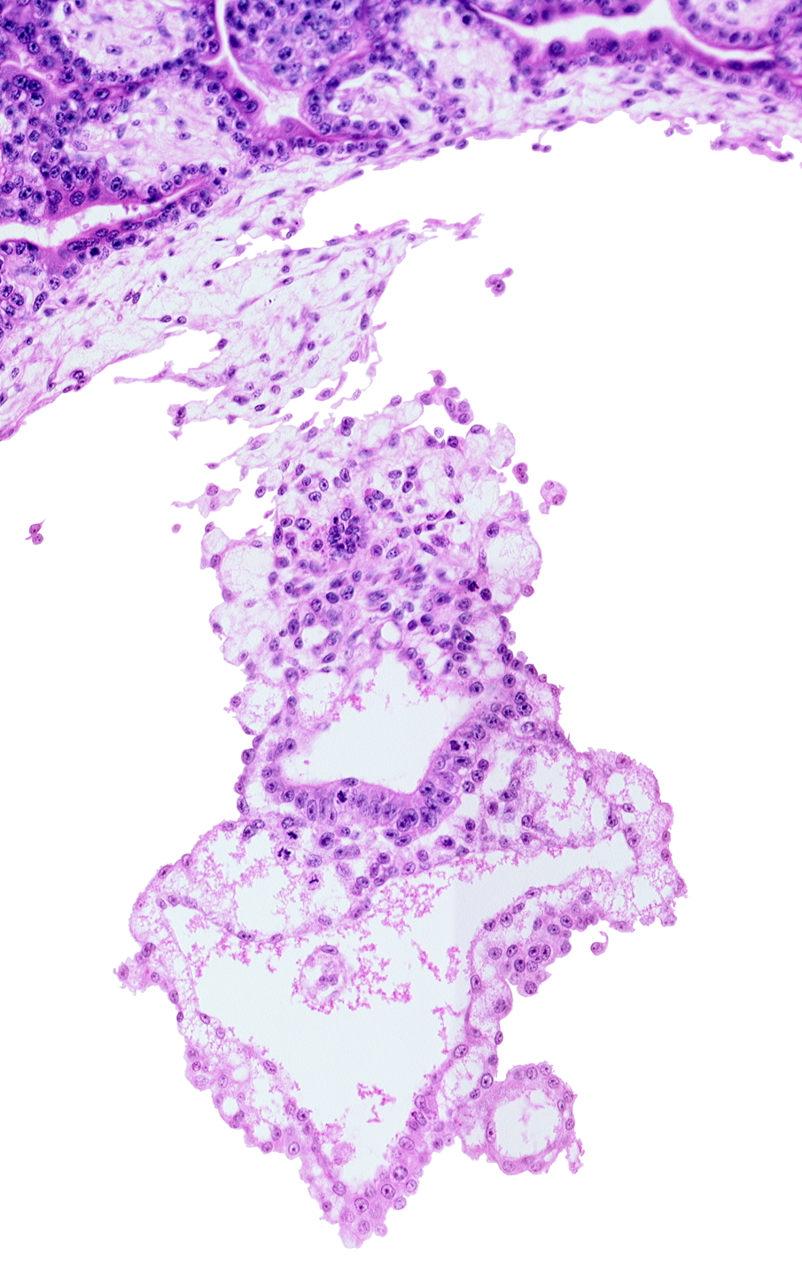 amniotic cavity, gastrulation (primitive) groove, umbilical vesicle cavity