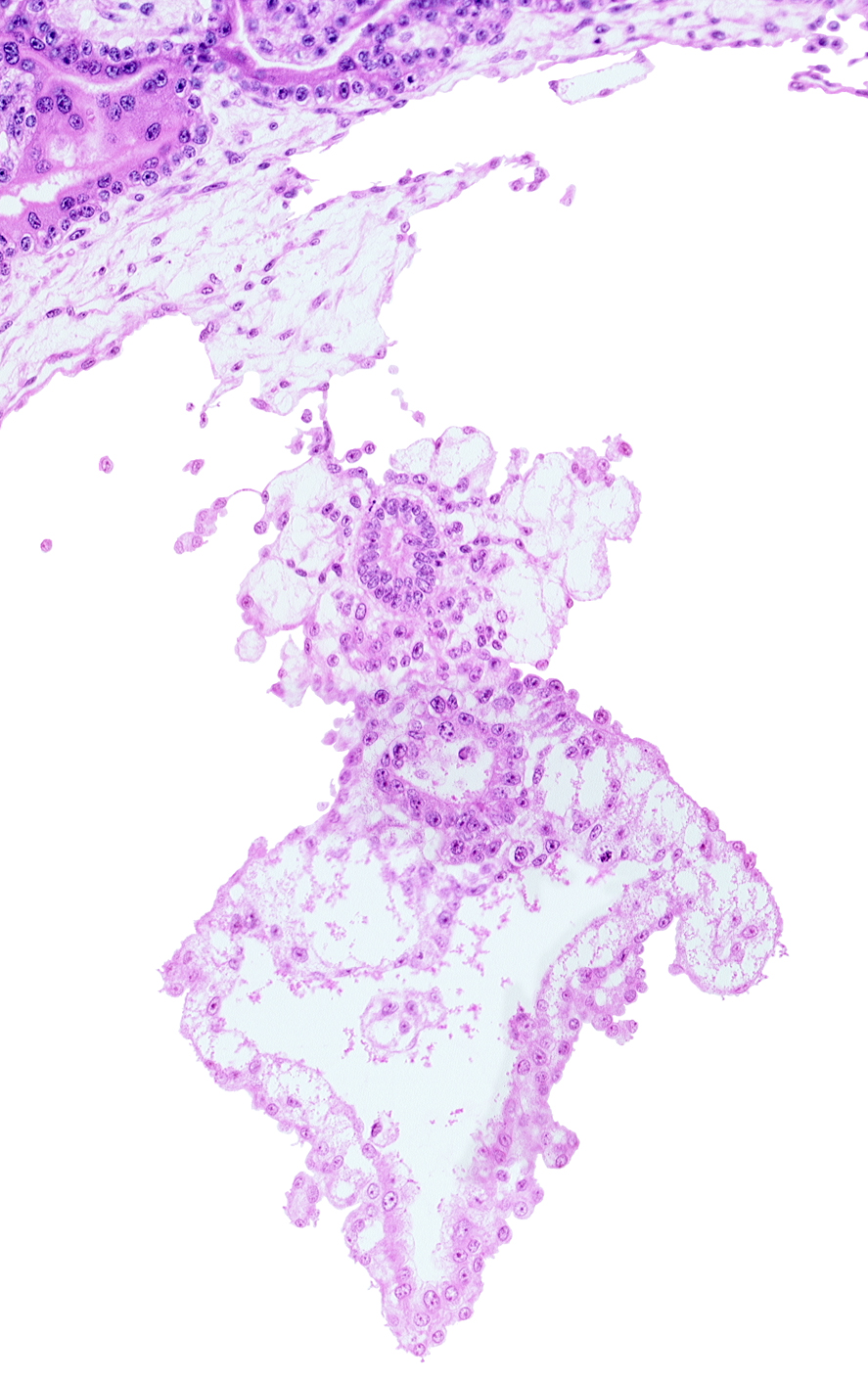 allantoic diverticulum (duct), caudal edge of amniotic cavity, cloacal membrane, embryonic endoderm, epiblast, internal cyst, umbilical vesicle cavity