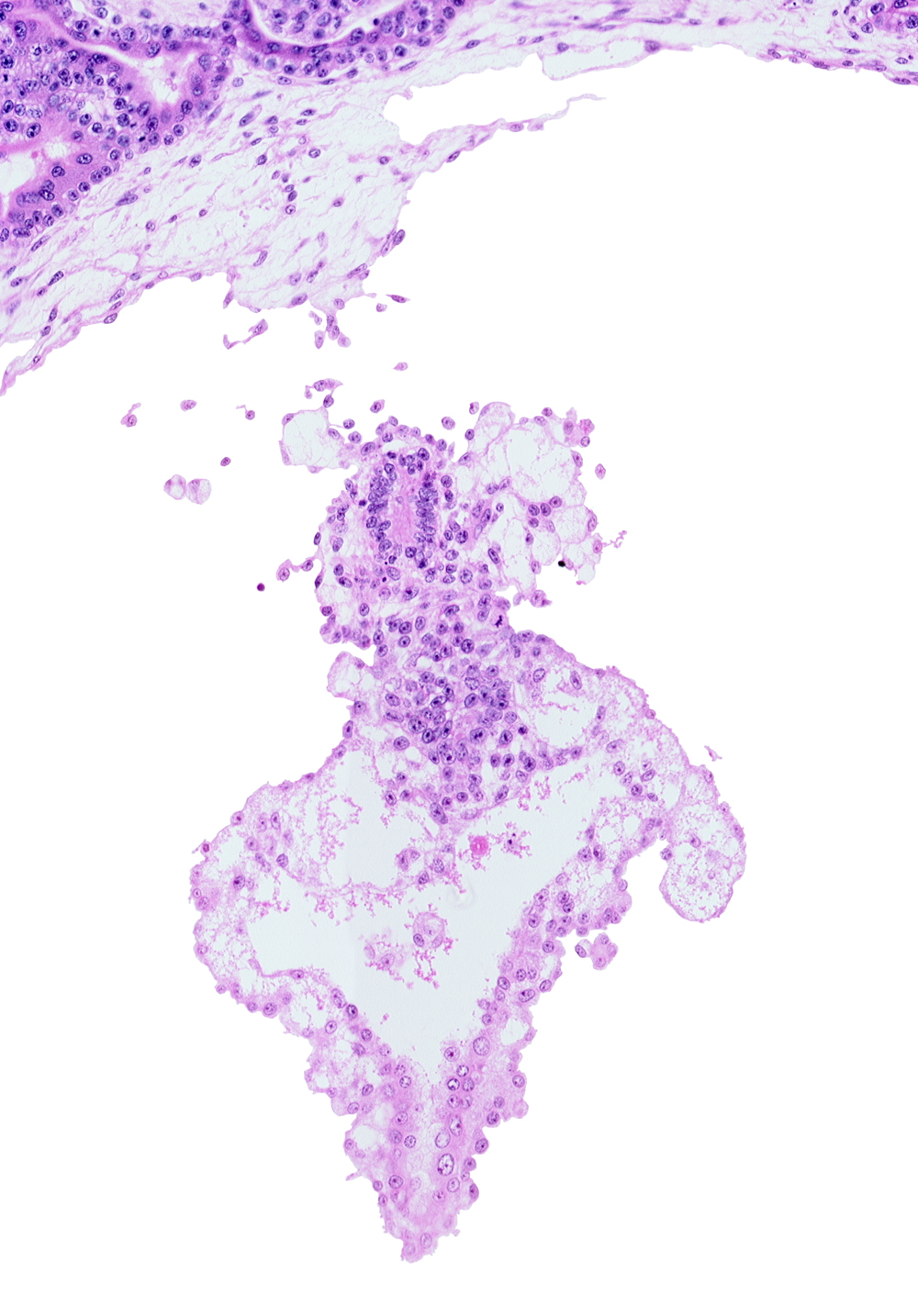 allantoic diverticulum (duct), allantoic mesenchyme, presumptive angioblastic tissue, primordial blood vessel(s)