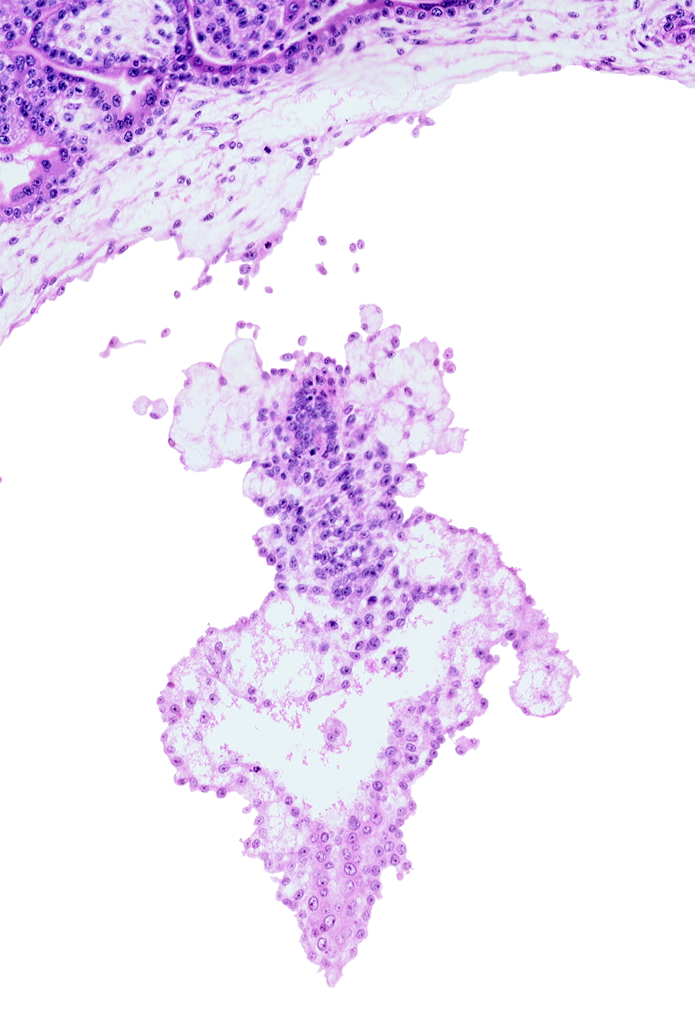 allantoic diverticulum (duct), allantoic mesenchyme, presumptive angioblastic tissue, primordial blood vessel(s)