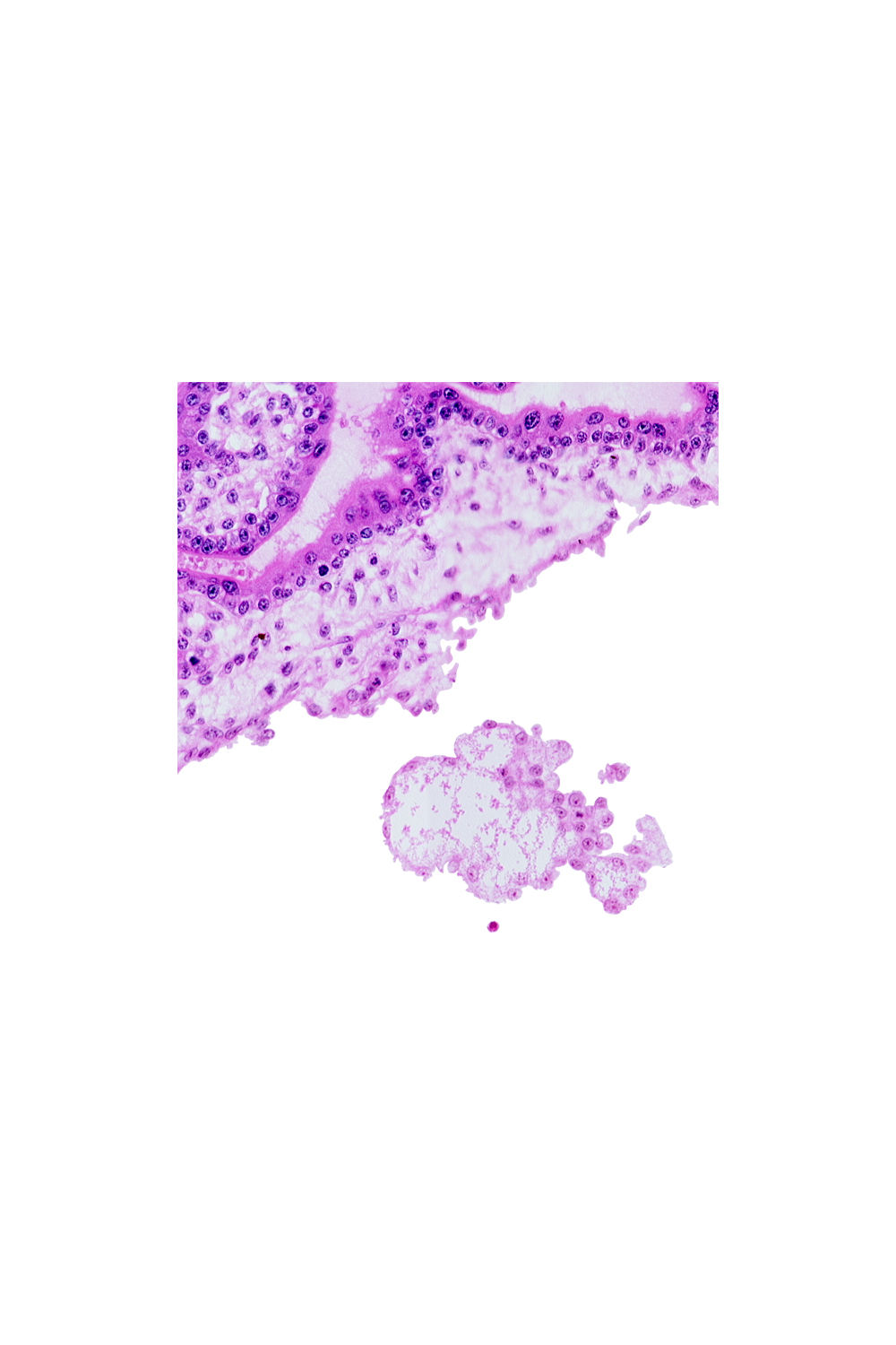 angioblastic tissue in secondary villus, chorionic plate, extra-embryonic mesoblast, intervillus space(s)