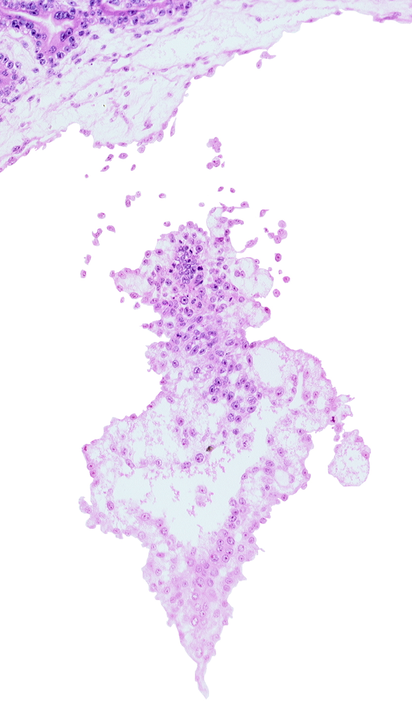 allantoic diverticulum (duct), allantoic mesenchyme, presumptive angioblastic tissue