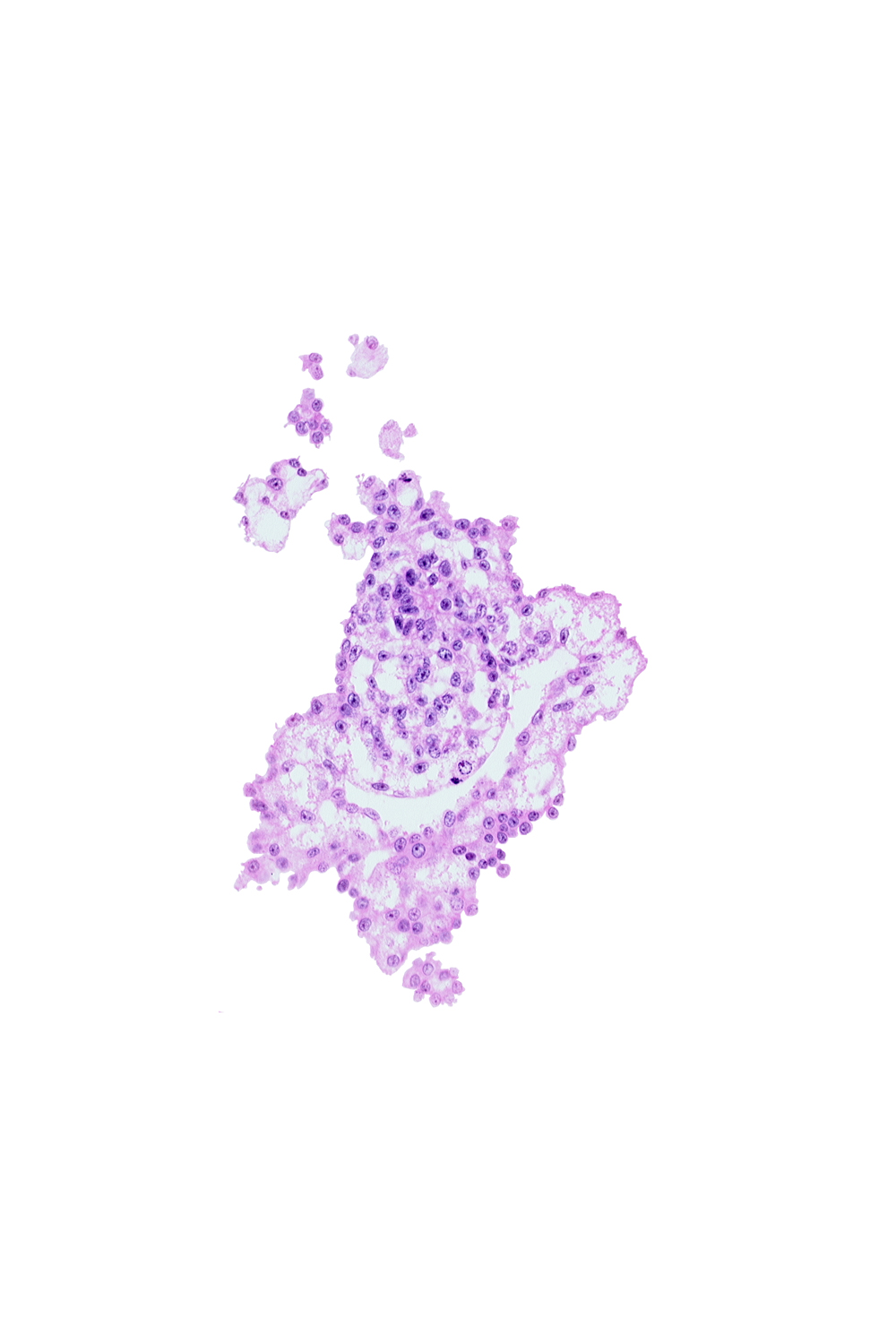 allantoic diverticulum (duct), allantoic mesenchyme, hemangiogenic tissue