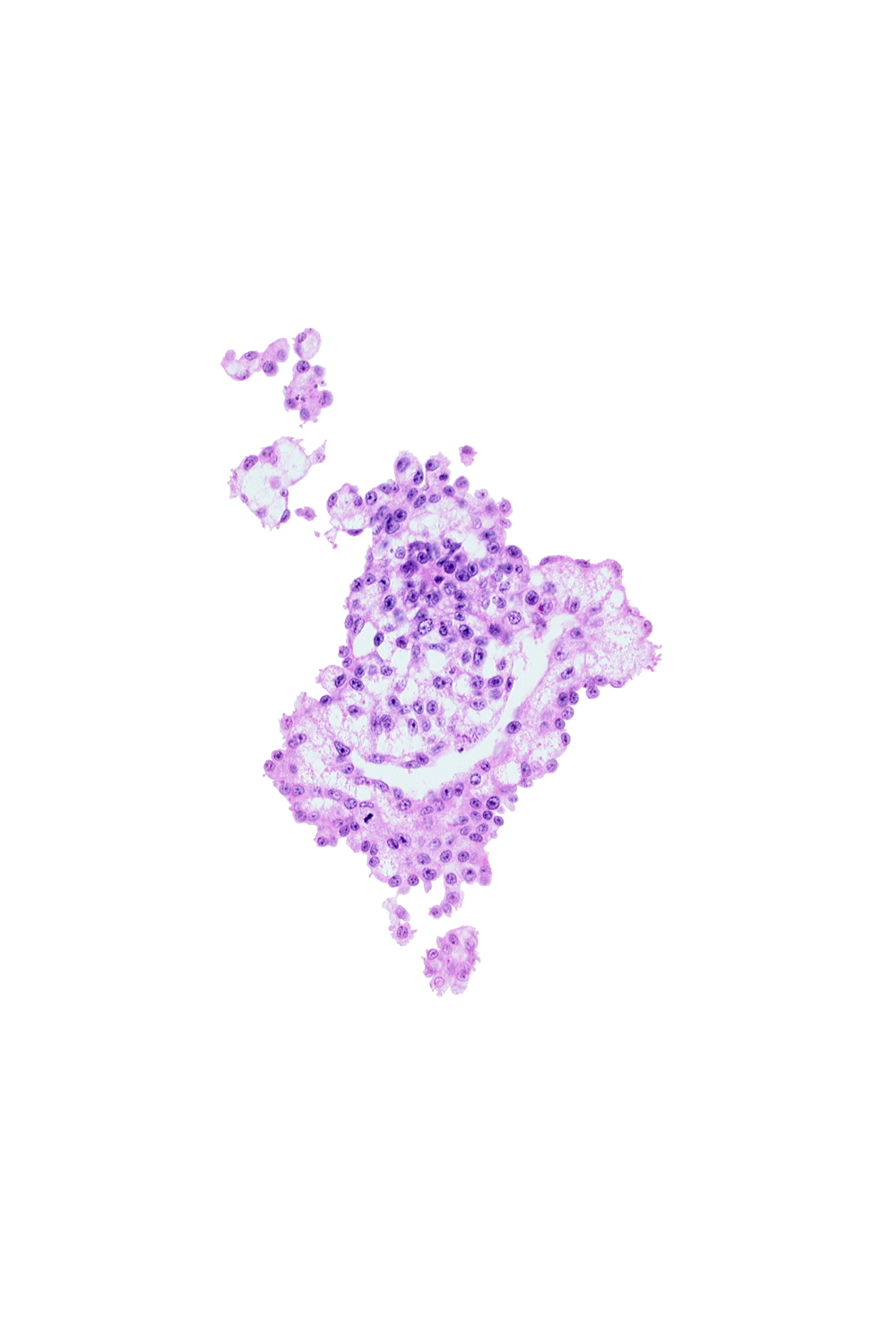 allantoic diverticulum (duct), allantoic mesenchyme, hemangiogenic tissue, umbilical vesicle cavity