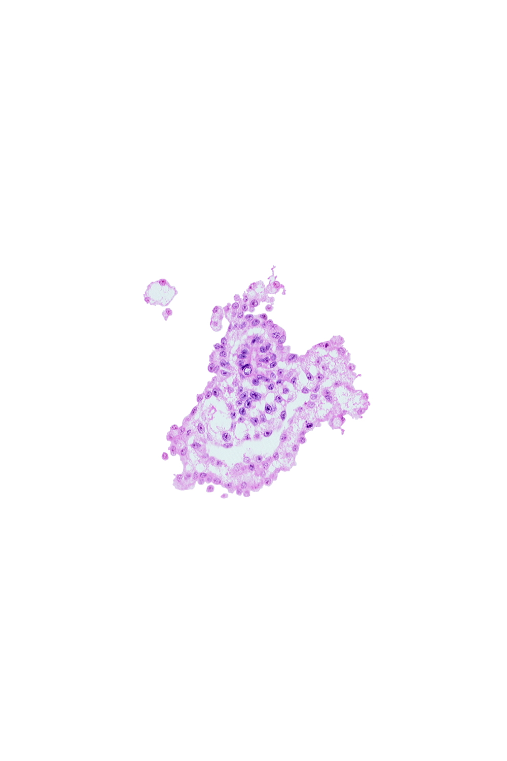 allantoic diverticulum, caudal part of umbilical vesicle cavity, junction of mesenchyme in connecting stalk and umbilical vesicle wall