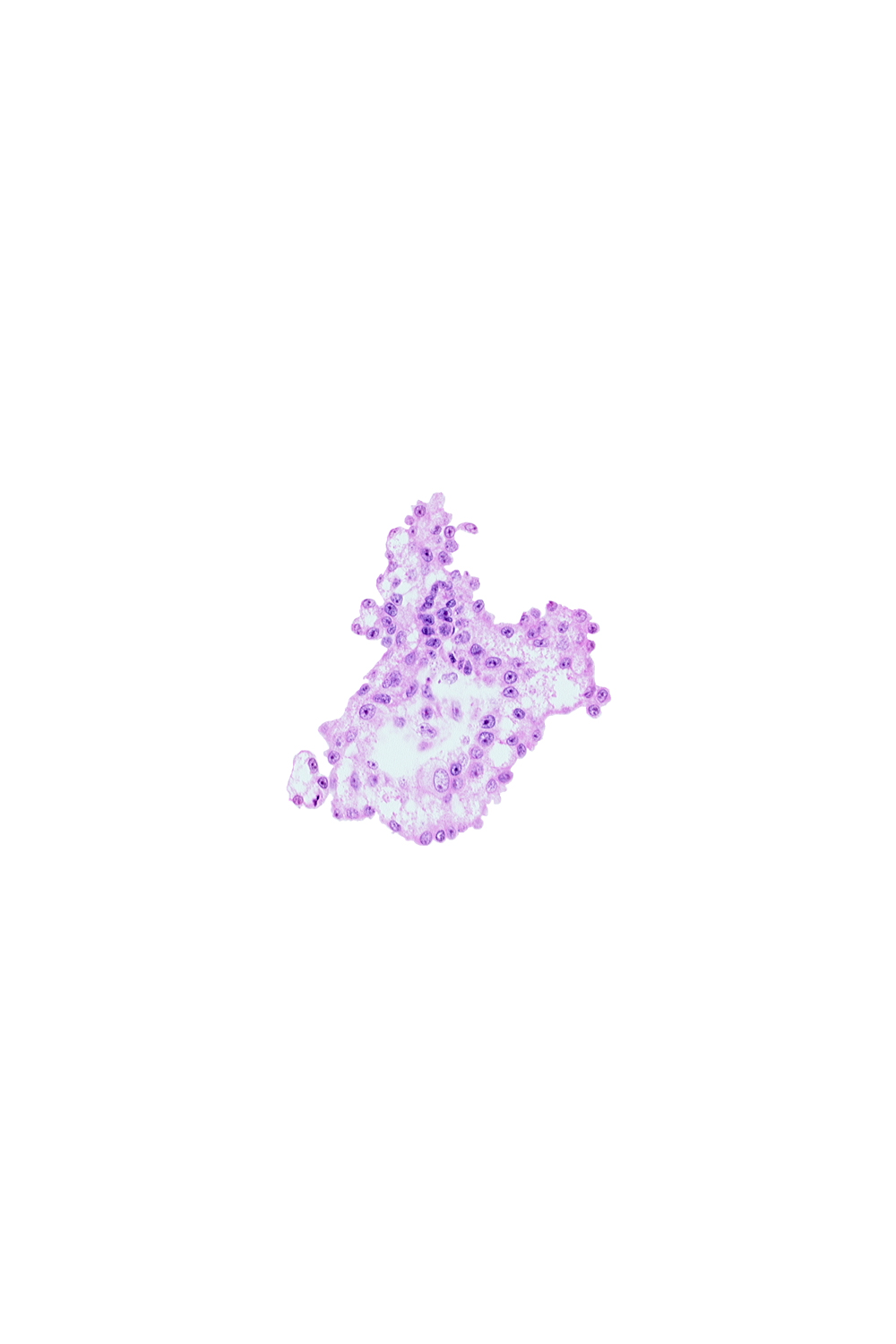 caudal part of umbilical vesicle cavity, junction of allantoic diverticulum and umbilical vesicle wall