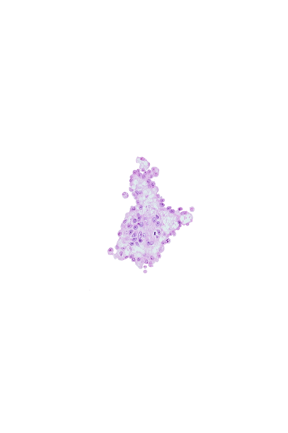 caudal part of umbilical vesicle wall