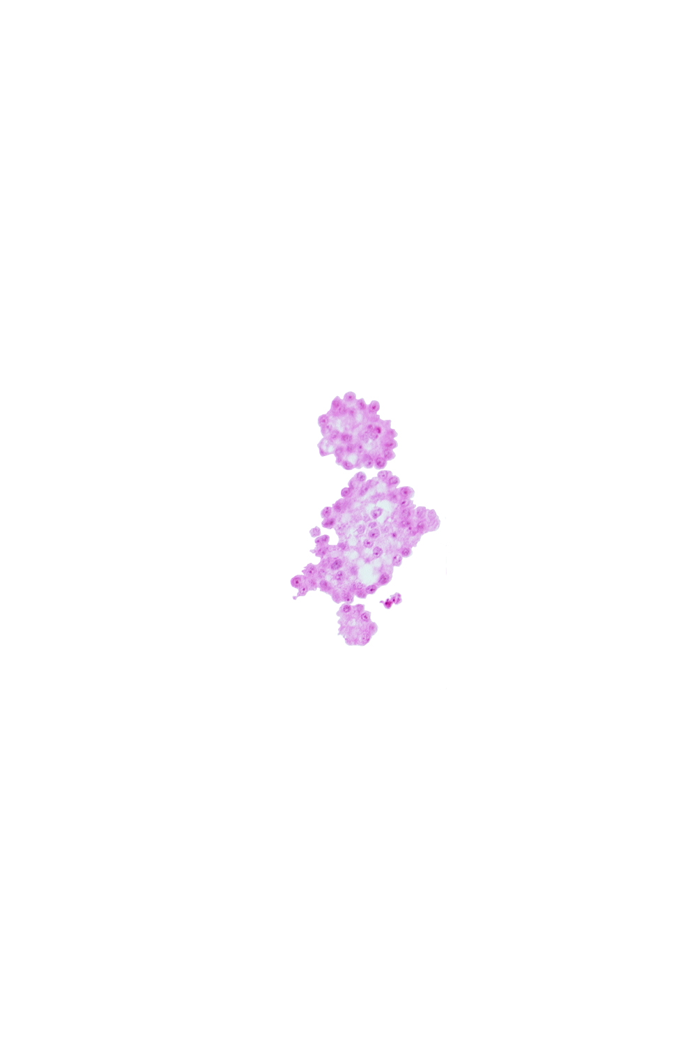 caudal part of umbilical vesicle wall
