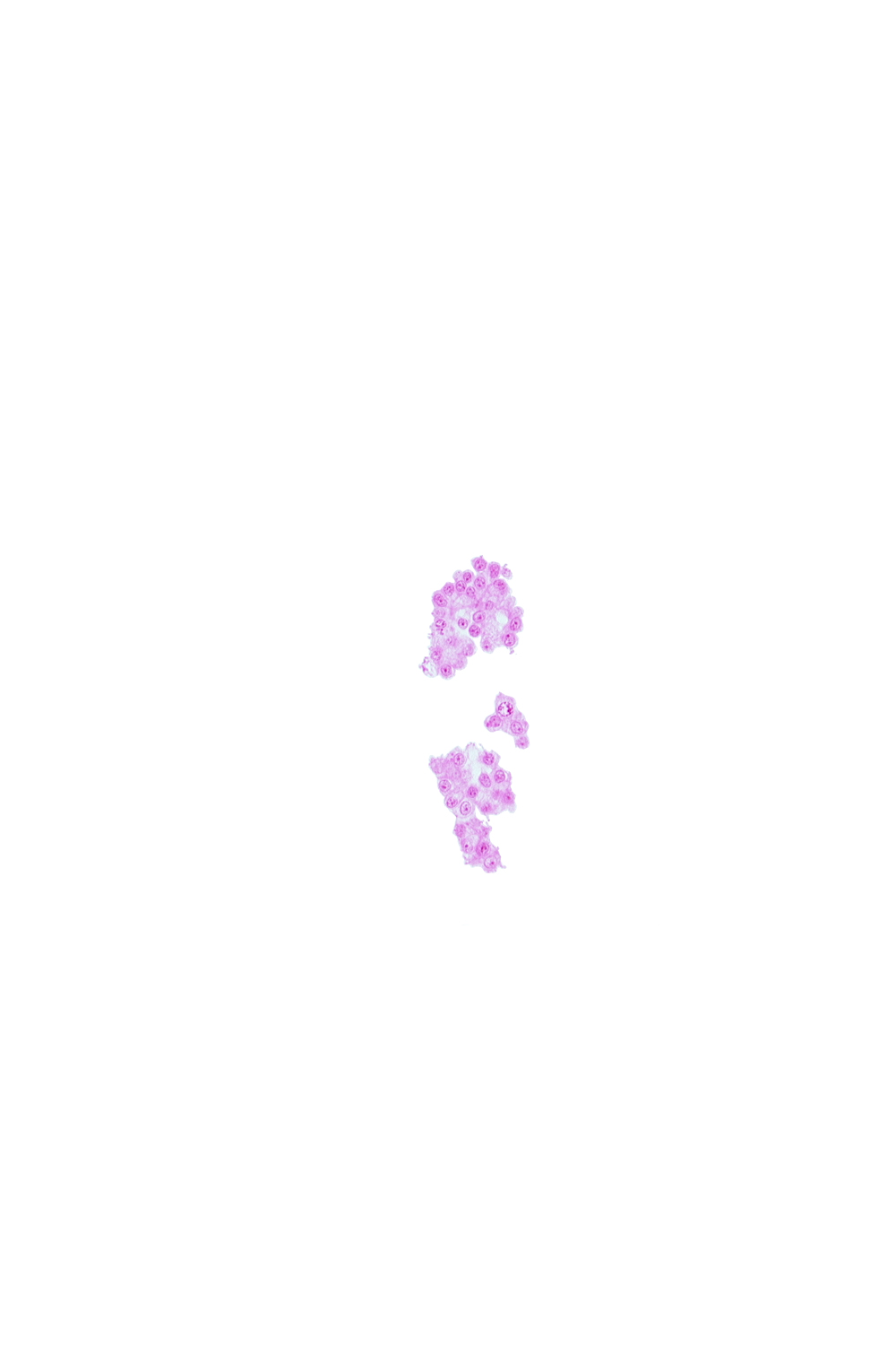 mesoblast(s) in caudal wall of secondary umbilical vesicle
