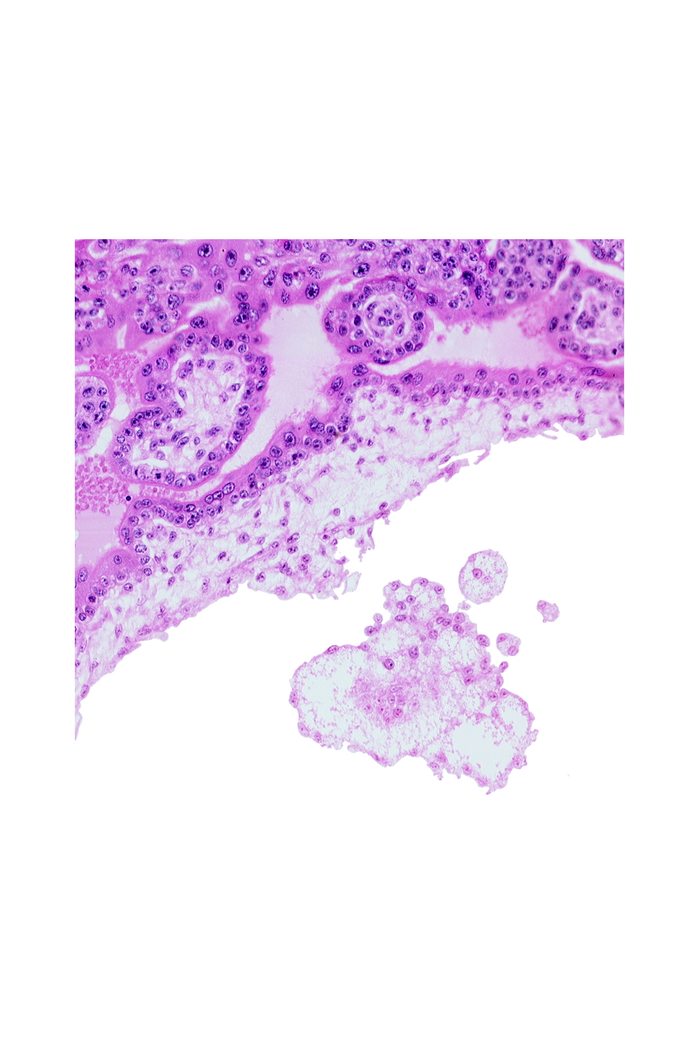 chorionic plate, extra-embryonic mesoblast, intervillus space(s)