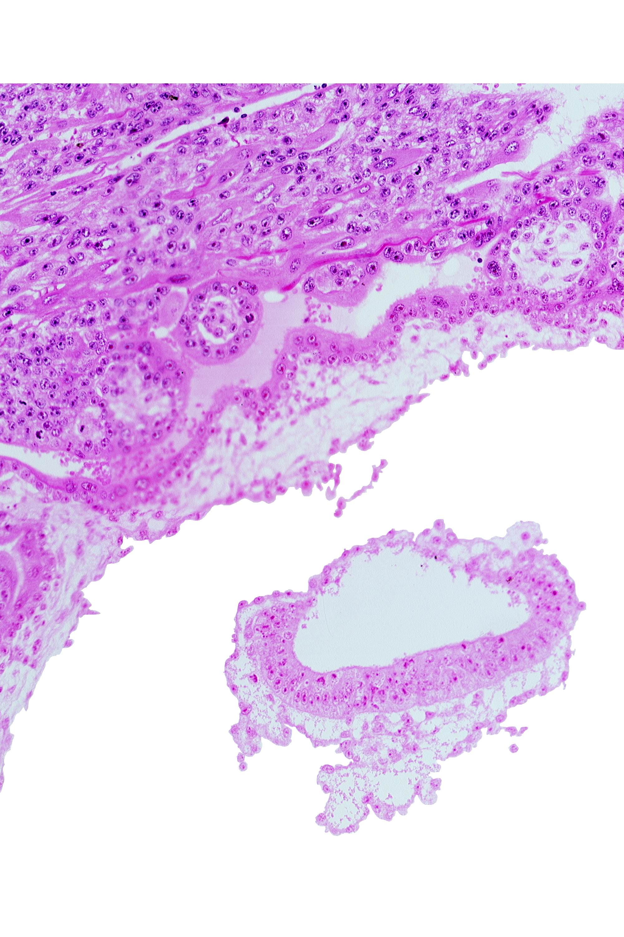 amnion, cephalic part of connecting stalk, head mesenchyme