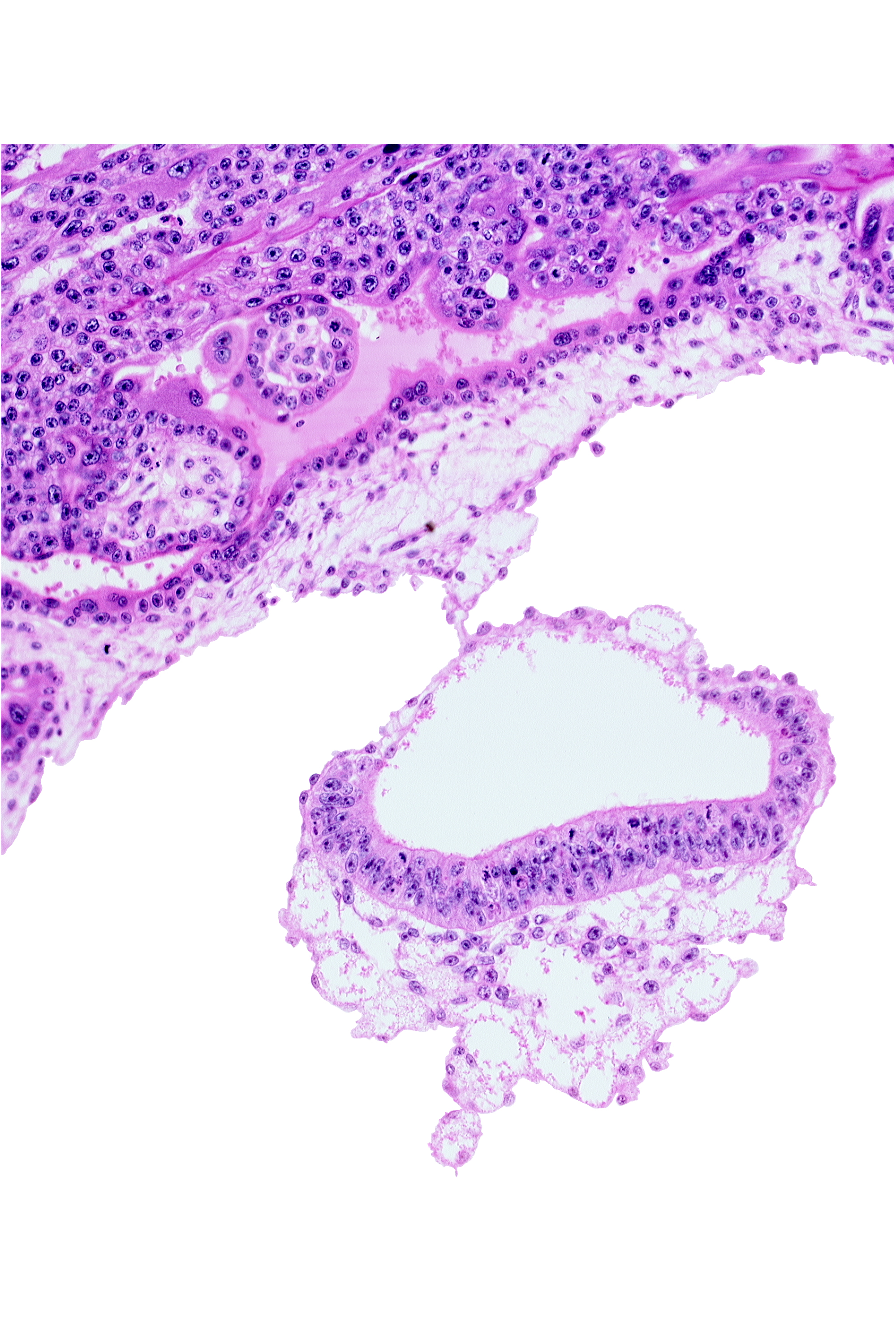 amnion, cephalic edge of umbilical vesicle cavity, epiblast, extra-embryonic endoderm, extra-embryonic mesoblast, head mesenchyme, hypoblast, junction of amnion and embryonic disc