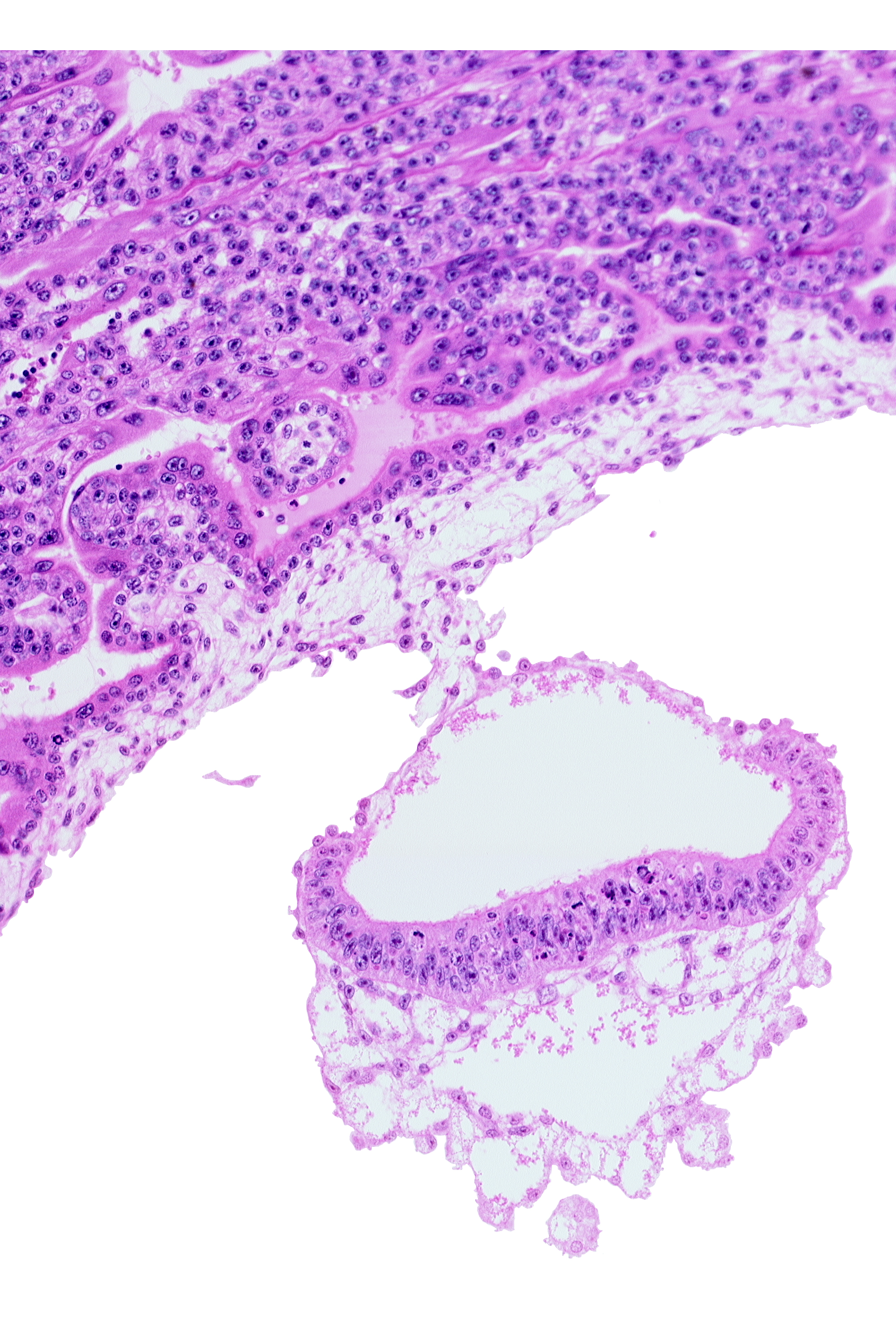 amnion, amniotic cavity, connecting stalk, epiblast, extra-embryonic endoderm, extra-embryonic mesoblast, head mesenchyme, hypoblast, umbilical vesicle cavity