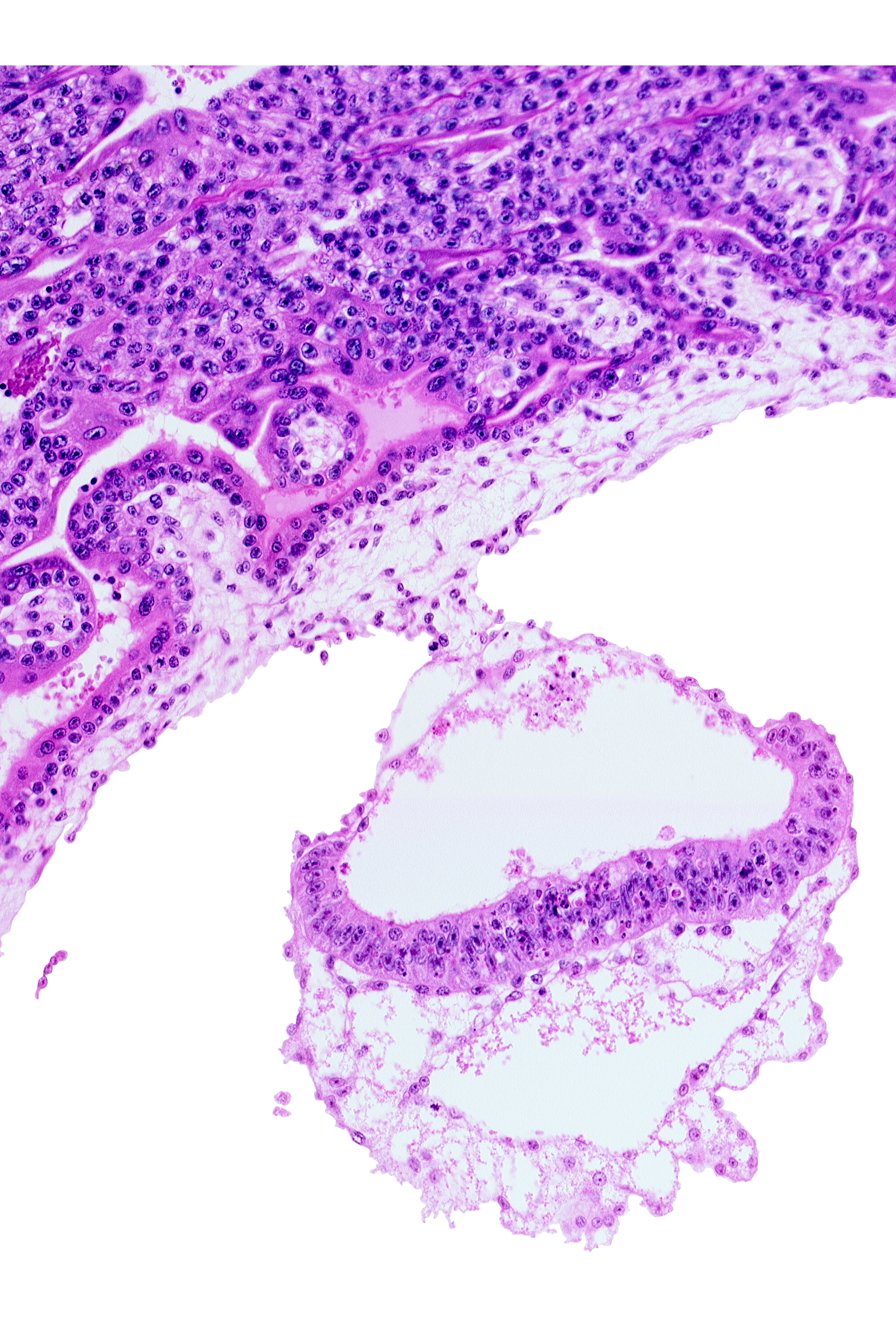 amniotic cavity, connecting stalk, extra-embryonic endoderm, mesothelium, two-layered umbilical vesicle wall, umbilical vesicle cavity