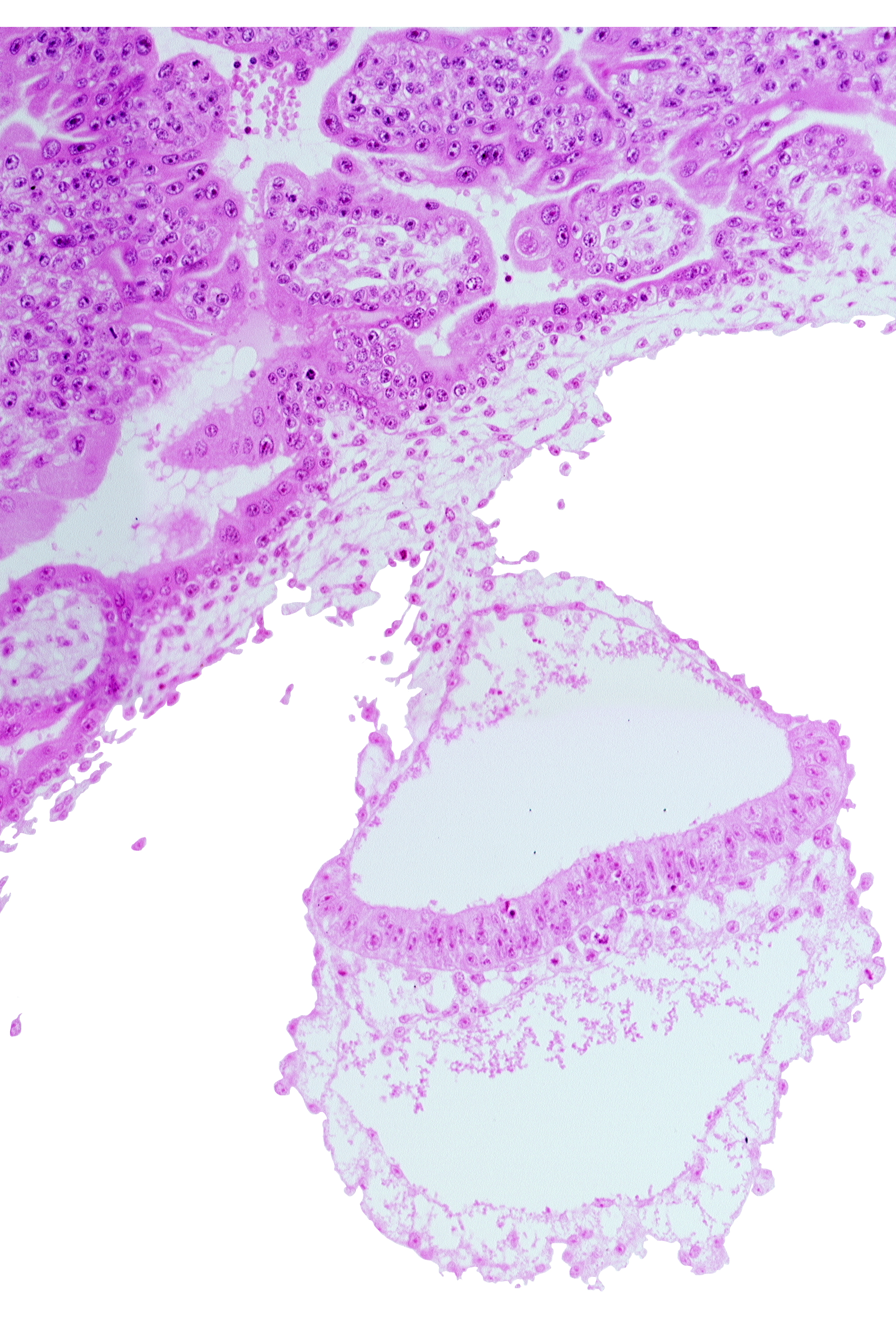 amniotic mesenchyme, epiblast, head mesenchyme, hemangiogenic tissue, hypoblast, notochordal process, presumptive neural plate, two-layered amnion, umbilical vesicle wall