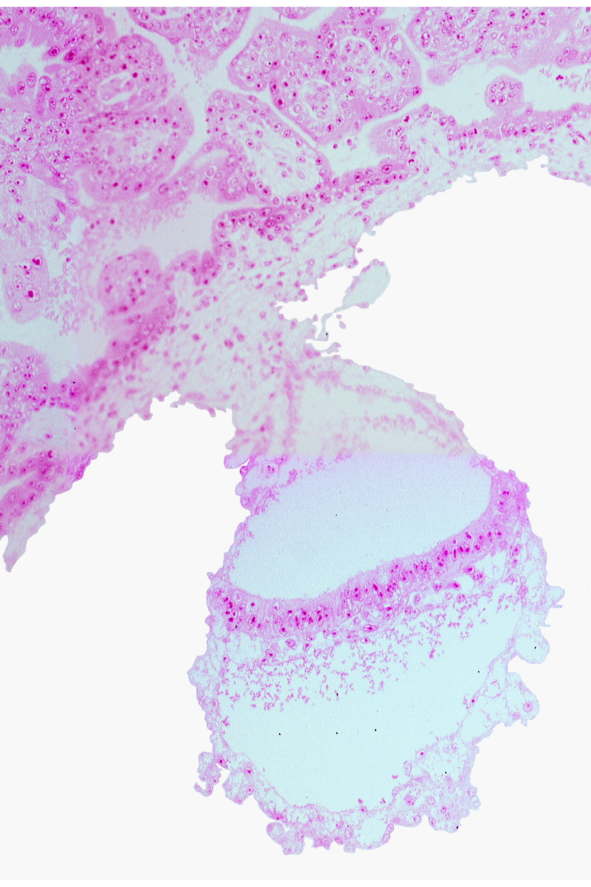connecting stalk, gastrulation (primitive) node, head mesenchyme, lateral edge of embryonic disc, mesothelium