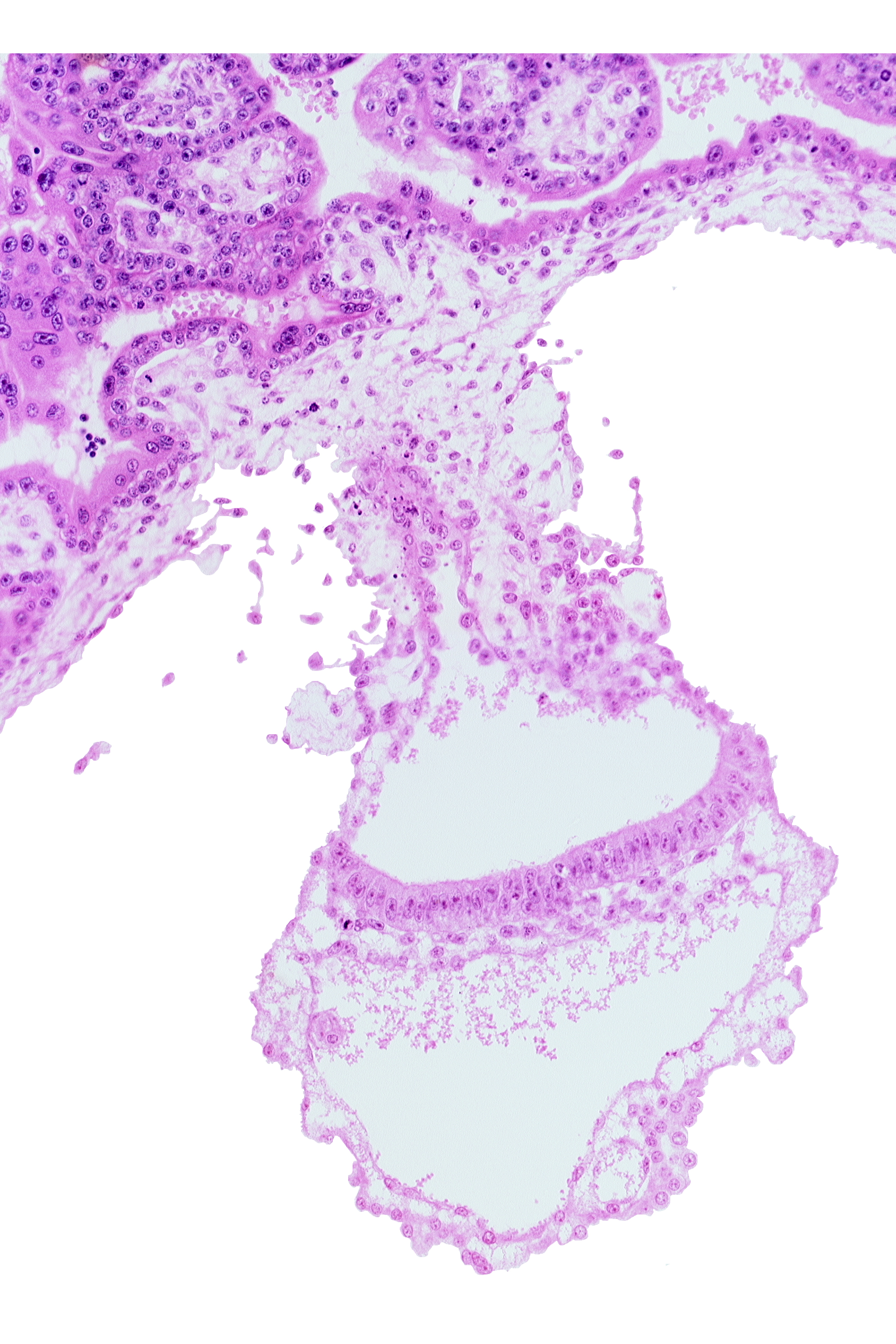cyst in umbilical vesicle wall, embryonic disc, embryonic endoderm, embryonic mesoderm, gastrulation (primitive) streak, lateral edge of embryonic disc, middle part of amniotic duct, presumptive angioblastic tissue