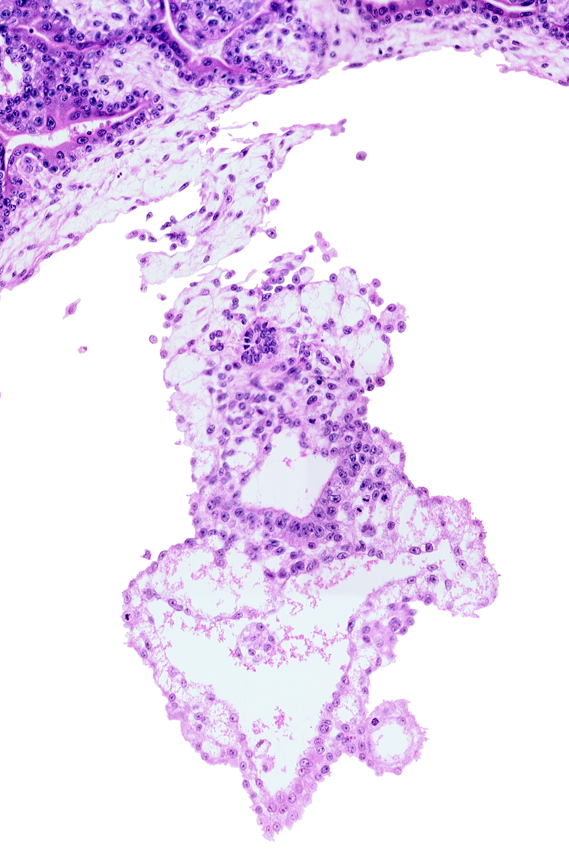 allantoic mesenchyme, amniotic cavity, caudal part of gastrulation (primitive) streak, distal end of allantoic diverticulum, embryonic endoderm, embryonic mesoderm, external cyst, internal cyst, primordial germ cell(s), umbilical vesicle wall