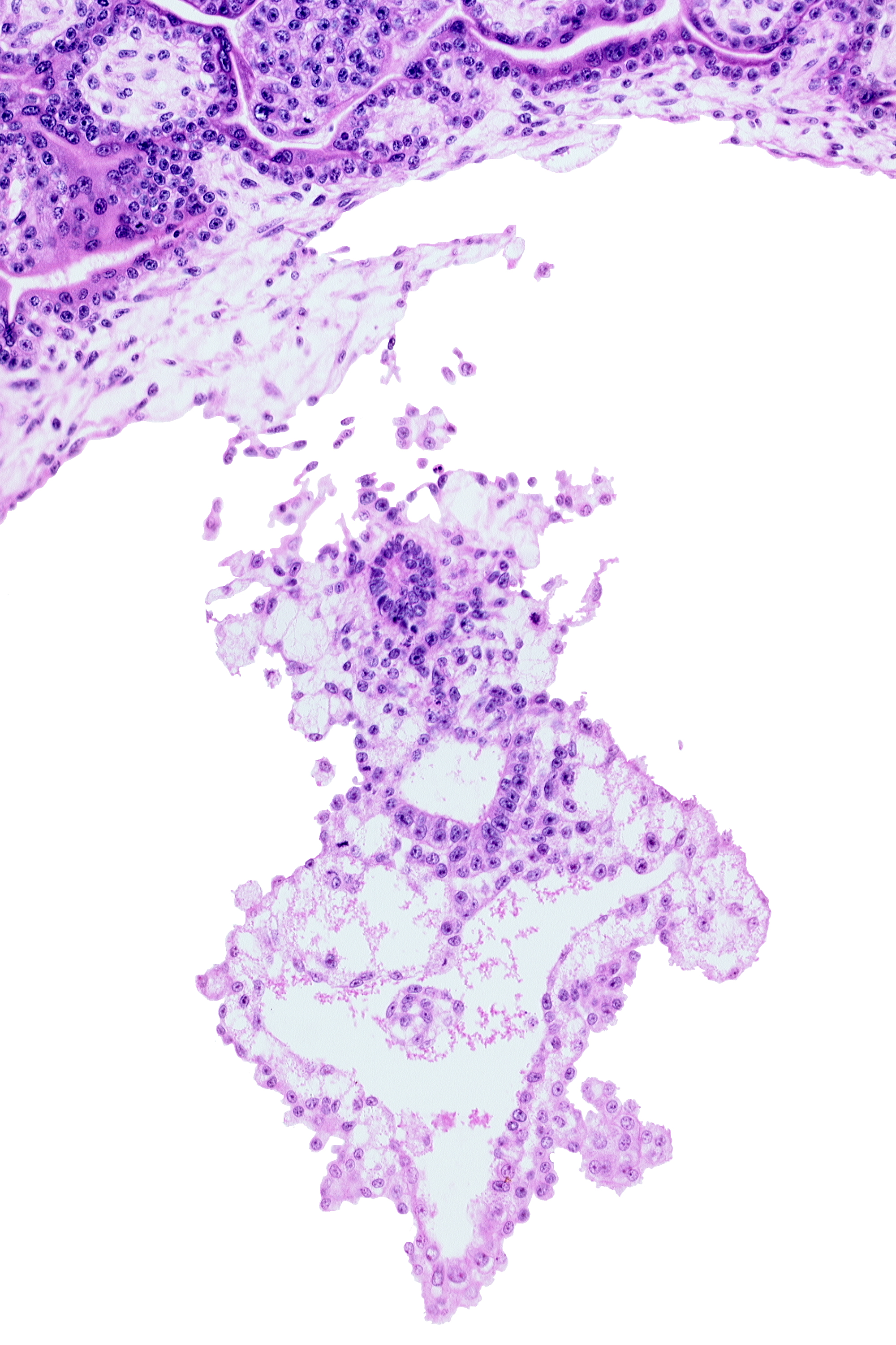 amniotic cavity, caudal part of external cyst, distal part of allantoic diverticulum, embryonic endoderm, embryonic mesoderm, internal cyst, umbilical vesicle cavity, umbilical vesicle wall