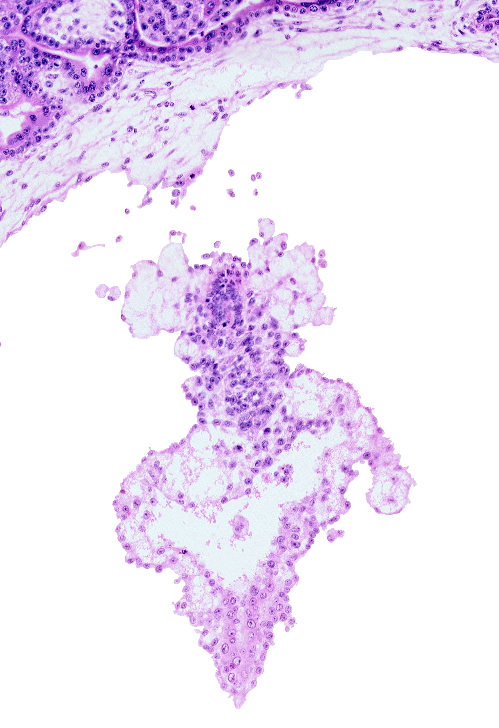 allantoic diverticulum (duct), allantoic mesenchyme, presumptive angioblastic tissue, primordial blood vessel(s)