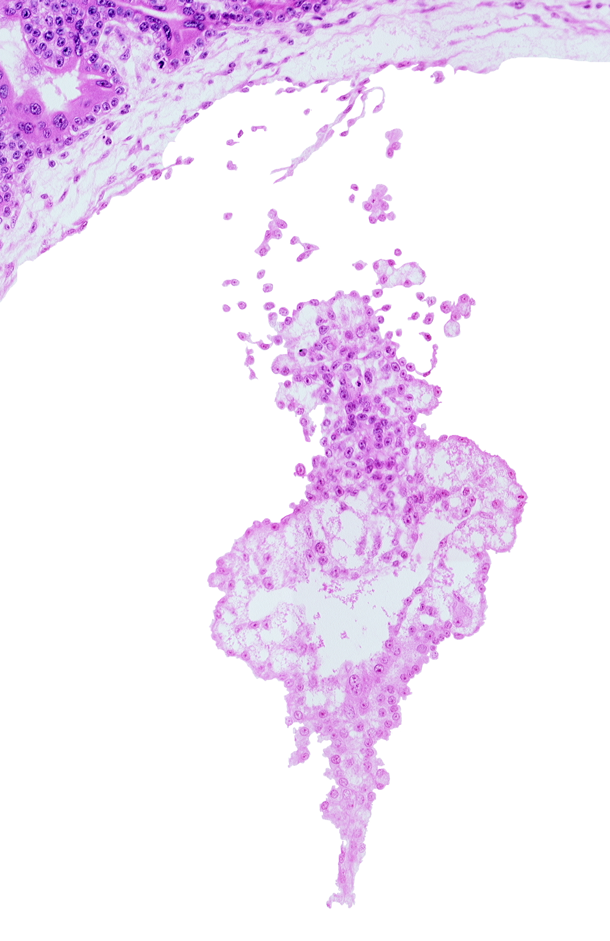 allantoic diverticulum (duct), allantoic mesenchyme, presumptive angioblastic tissue, umbilical vesicle cavity, umbilical vesicle process