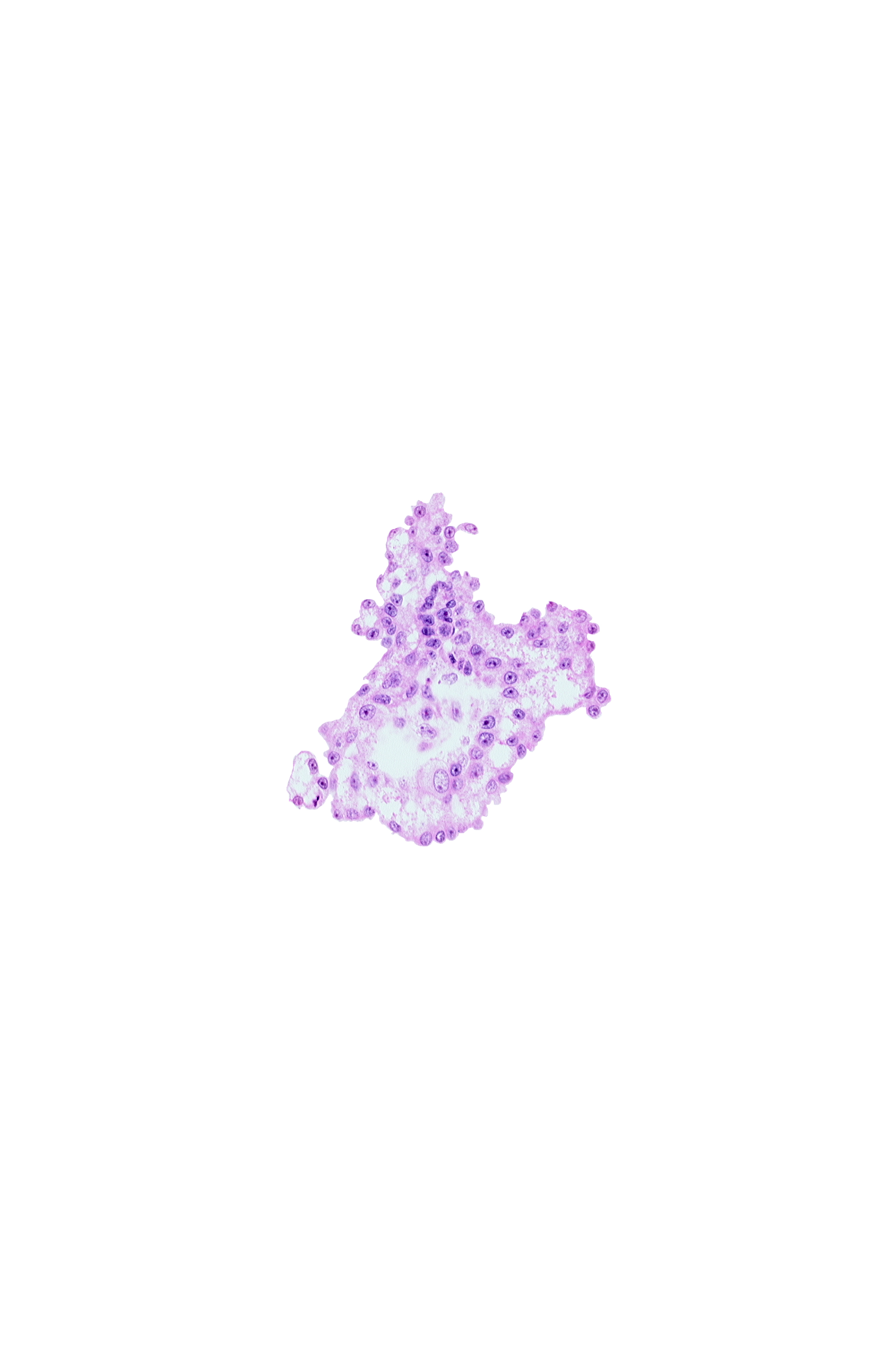 caudal part of umbilical vesicle cavity, junction of allantoic diverticulum and umbilical vesicle wall