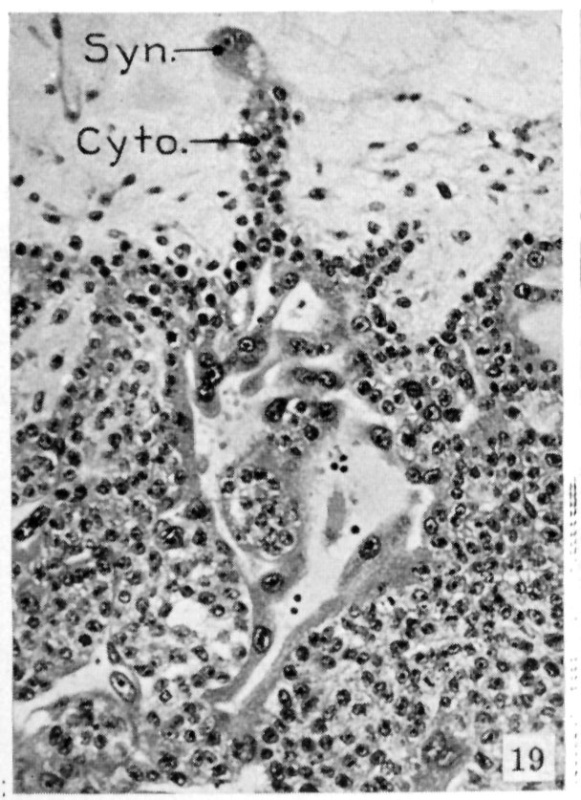 Cytotrophoblast 