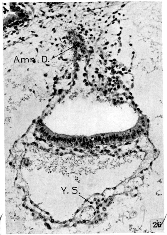 Amniotic duct