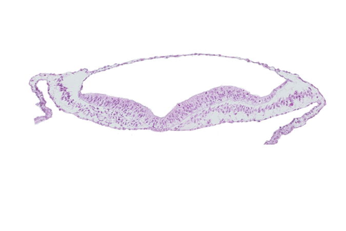 embryonic endoderm, extra-embryonic mesoderm, head mesenchyme, neural ectoderm, neural fold, neural groove, notochordal plate