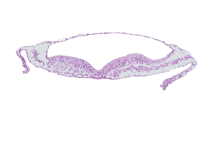 amnion, amniotic cavity, umbilical vesicle cavity, umbilical vesicle wall