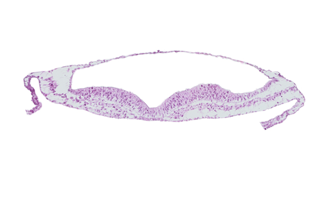 extra-embryonic mesoderm, head mesenchyme, neural ectoderm