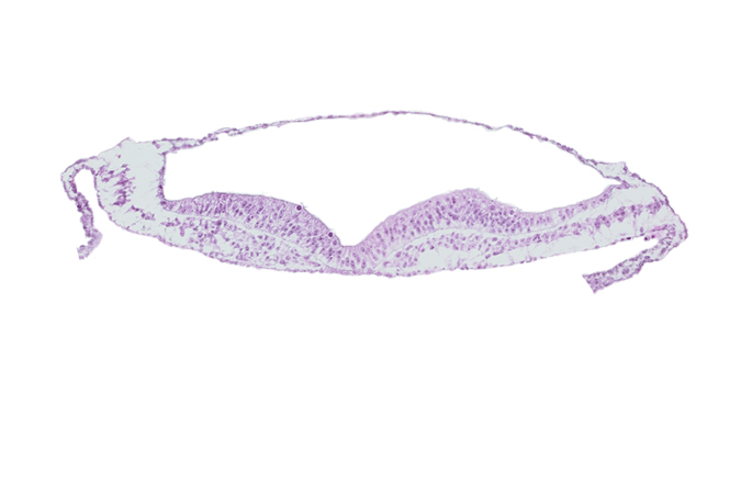 embryonic endoderm, neural fold, neural groove, notochordal plate, presumptive neural crest
