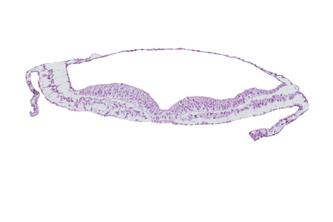 endoderm, extra-embryonic mesoderm, neural fold, neural groove, notochordal plate, transverse groove