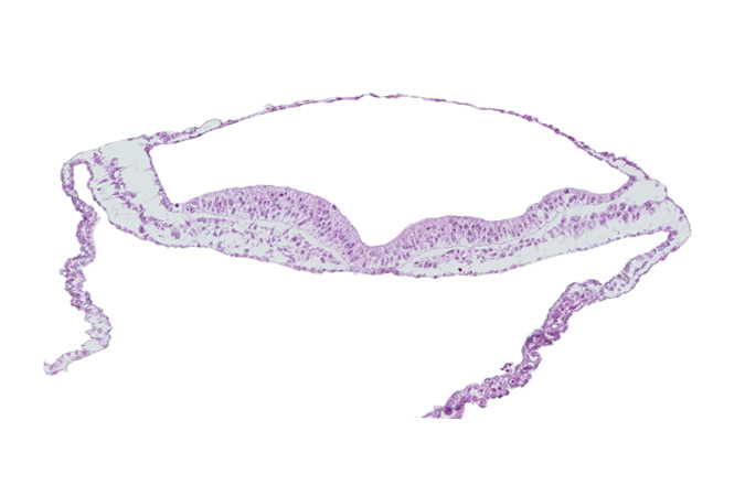 endoderm, neural groove, notochordal plate, transverse groove