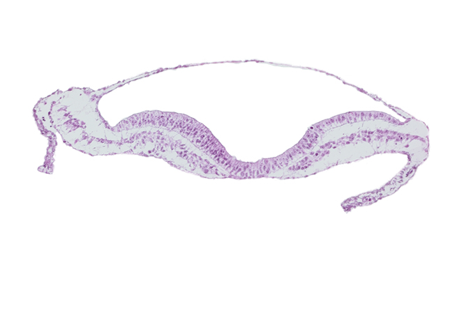 lateral plate mesoderm, neural groove, notochordal plate, paraxial mesoderm, umbilical vesicle hemangiogenesis