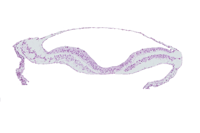 amnion, amniotic cavity, isolated coelomic space, notochordal plate