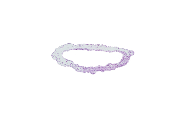 umbilical vesicle cavity