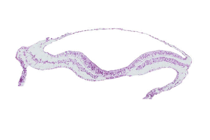 amnion, extra-embryonic endoderm, extra-embryonic mesoderm, head mesenchyme, neural fold, neural groove, notochordal plate, umbilical vesicle cavity, ventral groove (artifact?)