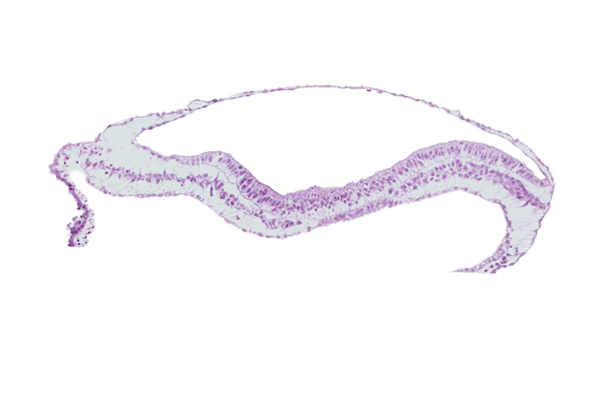 amnion, amniotic cavity, head mesenchyme, neural fold, neural groove, notochordal process